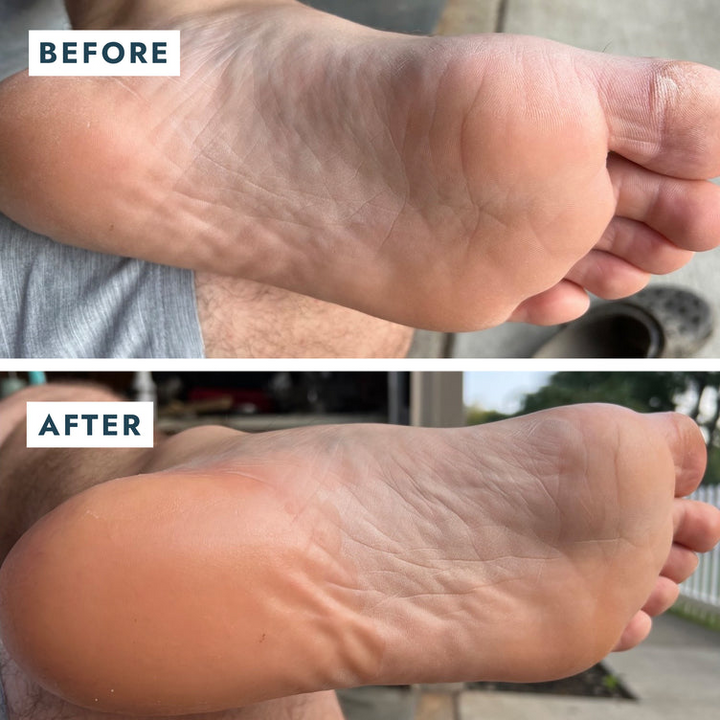 SoleMate Heel Repair Balm