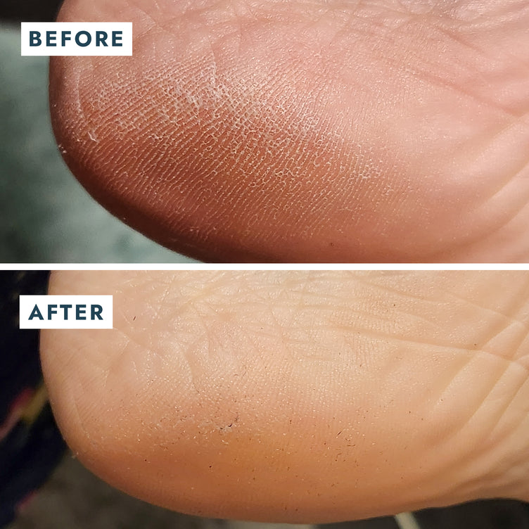 SoleMate Heel Repair Balm